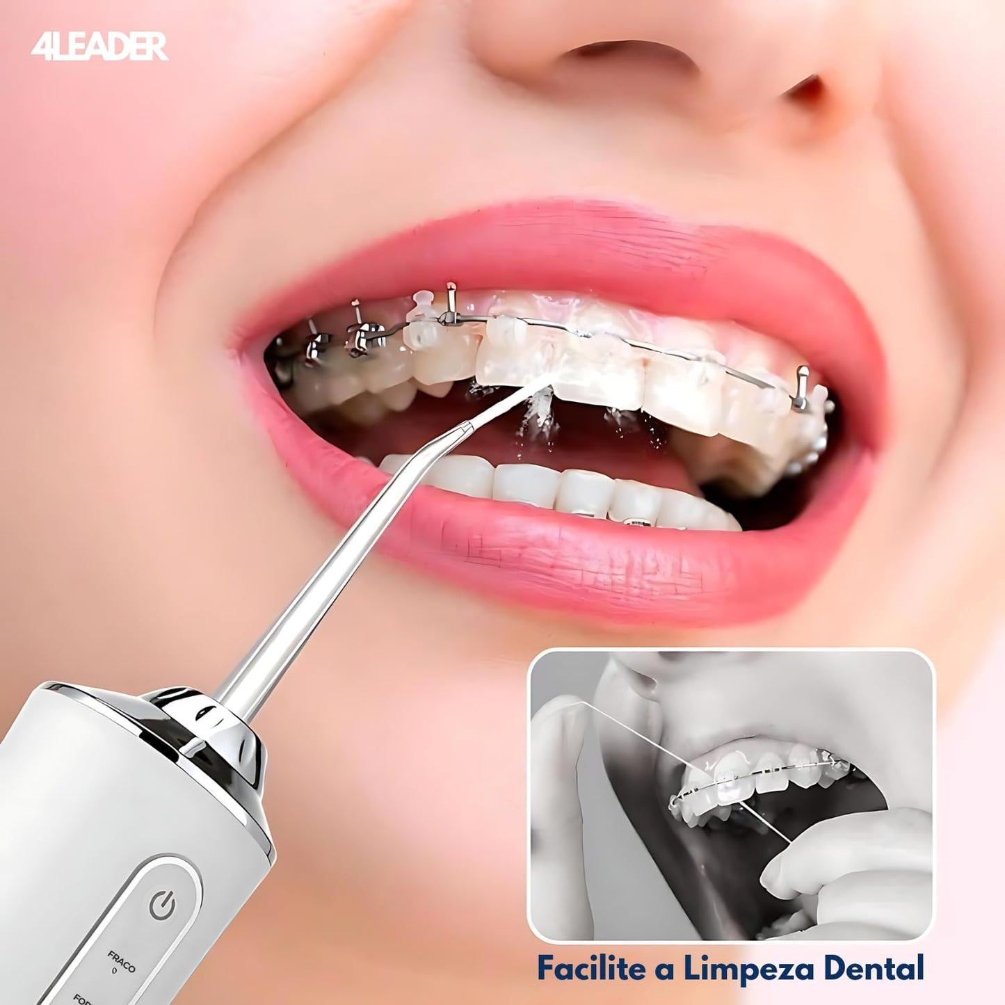 Irrigador Oral 4Leader - Irrigador Bucal Elétrico para Limpeza Dental Profunda, Anti Tártaro com 3 Velocidades, Raspador de Língua, Recarregável via Cabo USB C e Bateria de Alta Duração Portátil
